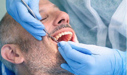 Dr. Aldo Moreno Implantes dentales en Miraflores Dr. Aldo Moreno Implantes dentales en Miraflores