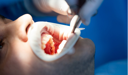 Dr. Aldo Moreno Implantes dentales en Miraflores Dr. Aldo Moreno Implantes dentales en Miraflores